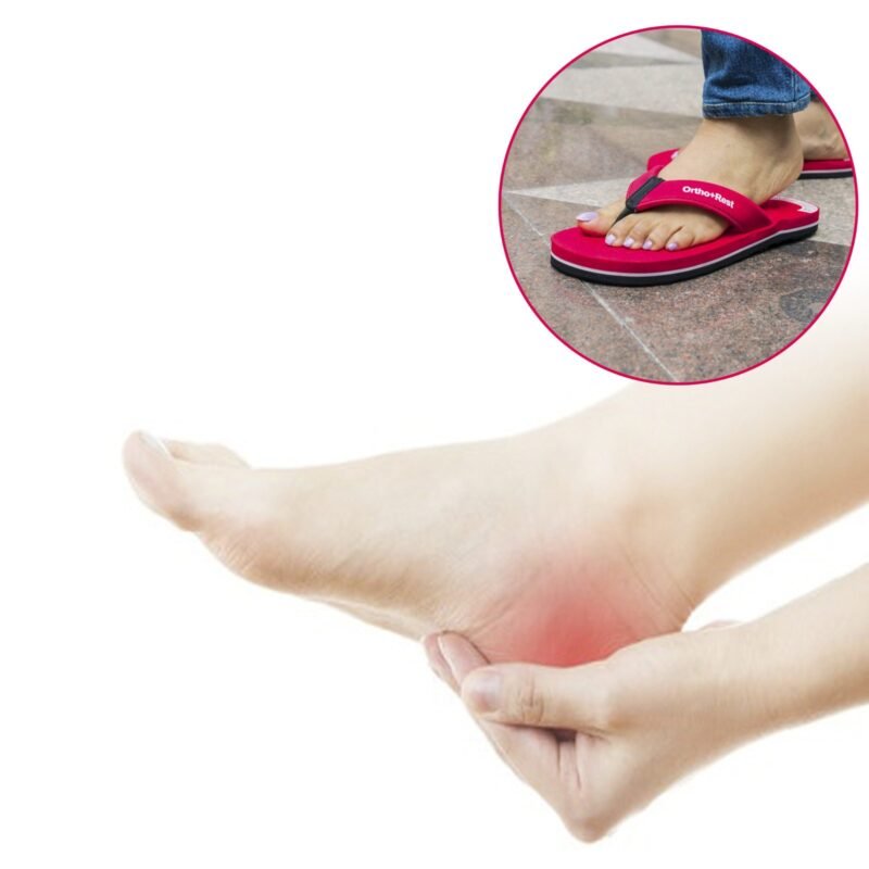 How Does a Flip Flop Can Heal Your Pain